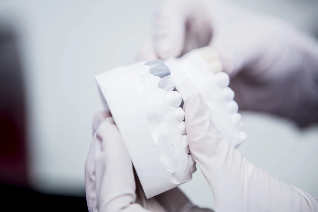 Waarom Composite Bonding laten doen?